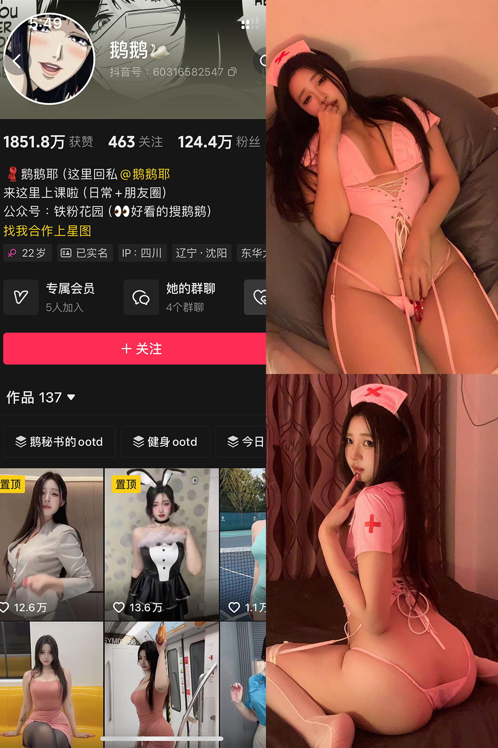 抖音 鹅鹅 铁粉空间 NO.008期 【52P15V】-杏子