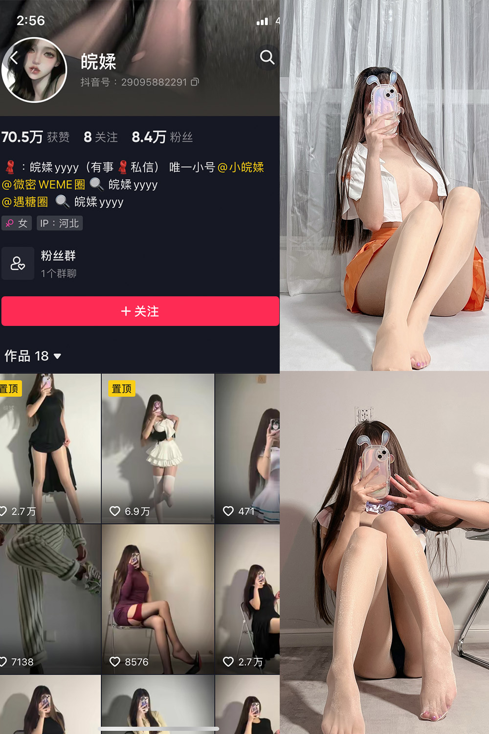 抖音 皖媃yyyy VIP 微密圈  NO.002期 【20V】-杏子