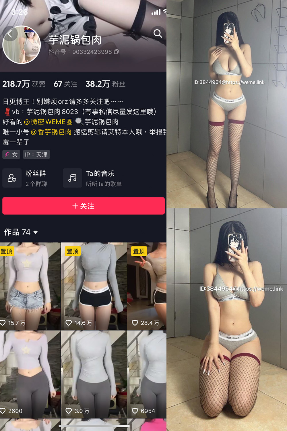 抖音 芋泥锅包肉 微密圈  NO.005期 【16P9V】-杏子