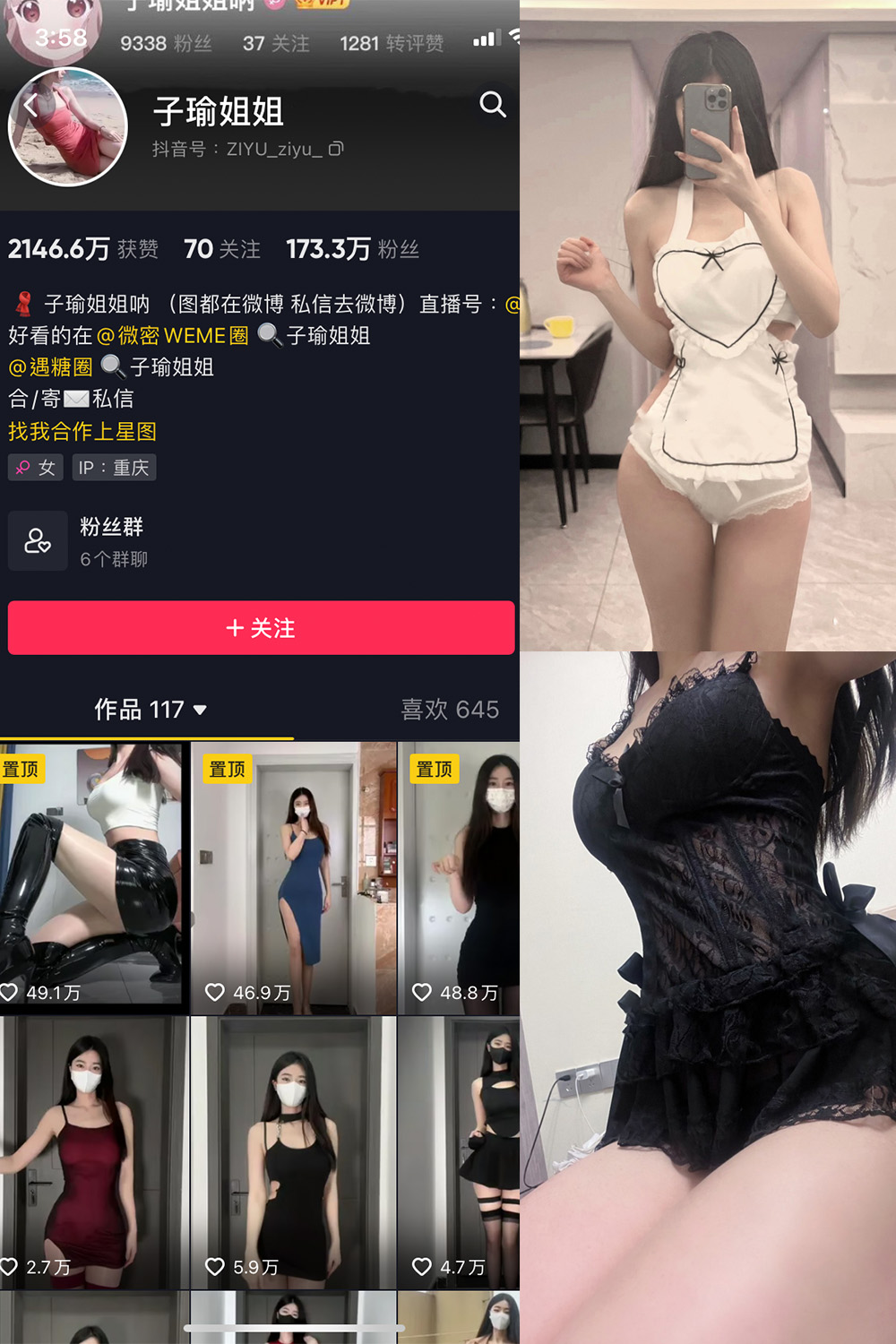 抖音 子瑜姐姐 微密圈  NO.014期 【13P】-杏子