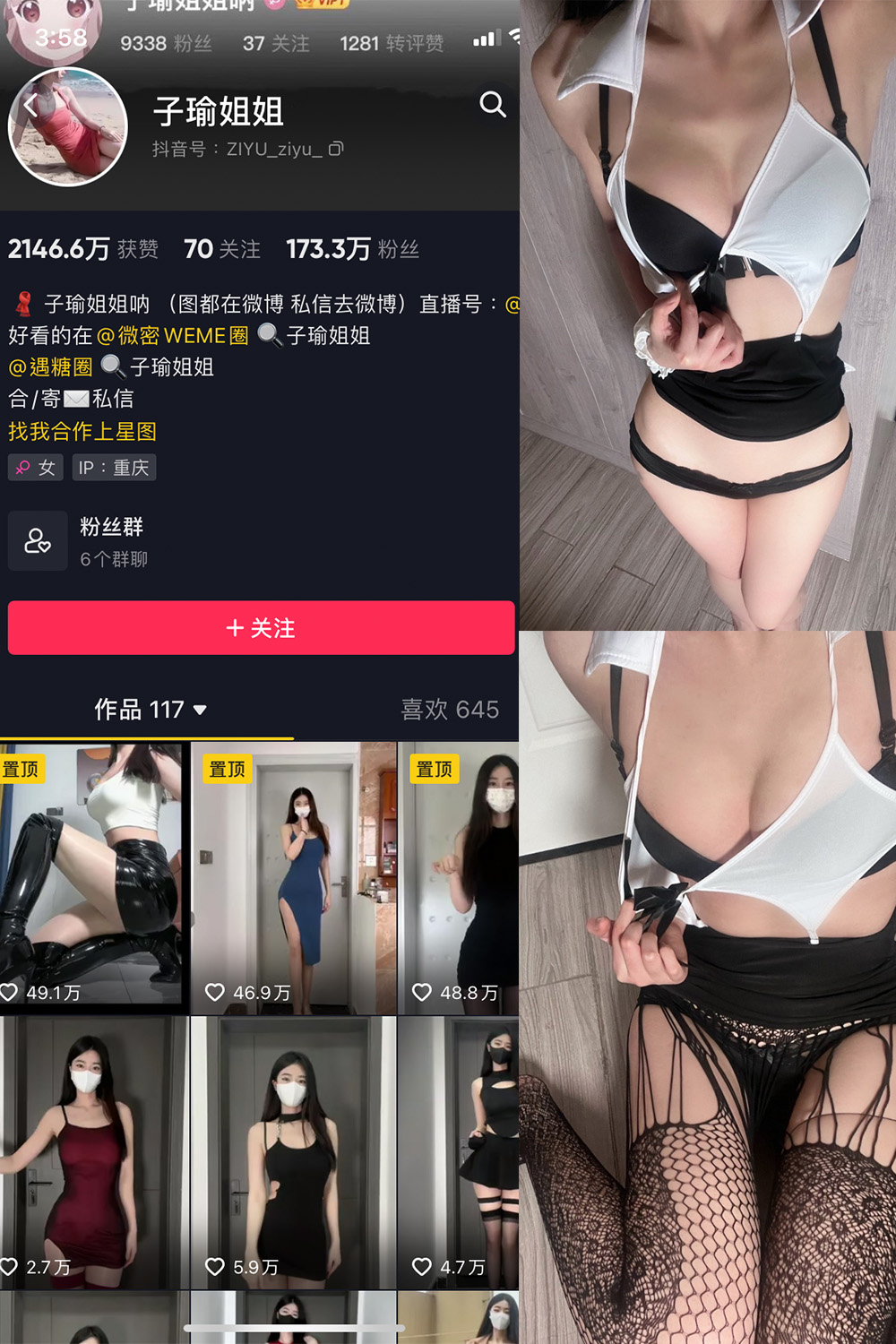 抖音 子瑜姐姐 微密圈  NO.013期 【20P】-杏子