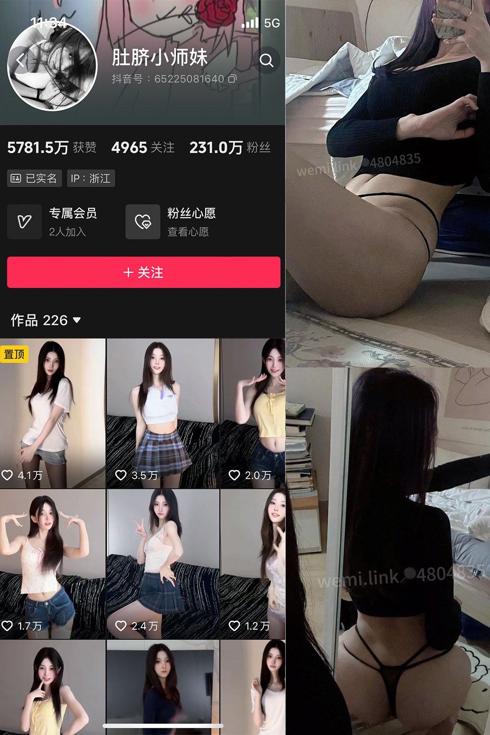 抖音 肚脐小师妹 微密圈  NO.033期 【19P3V】最新至：2024.8.24-杏子