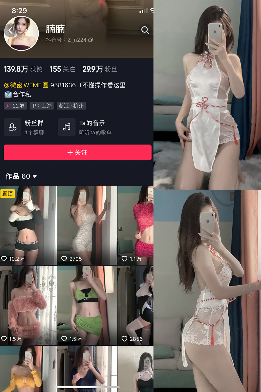 抖音 腩腩 微密圈  NO.001期 【14P】最新-杏子