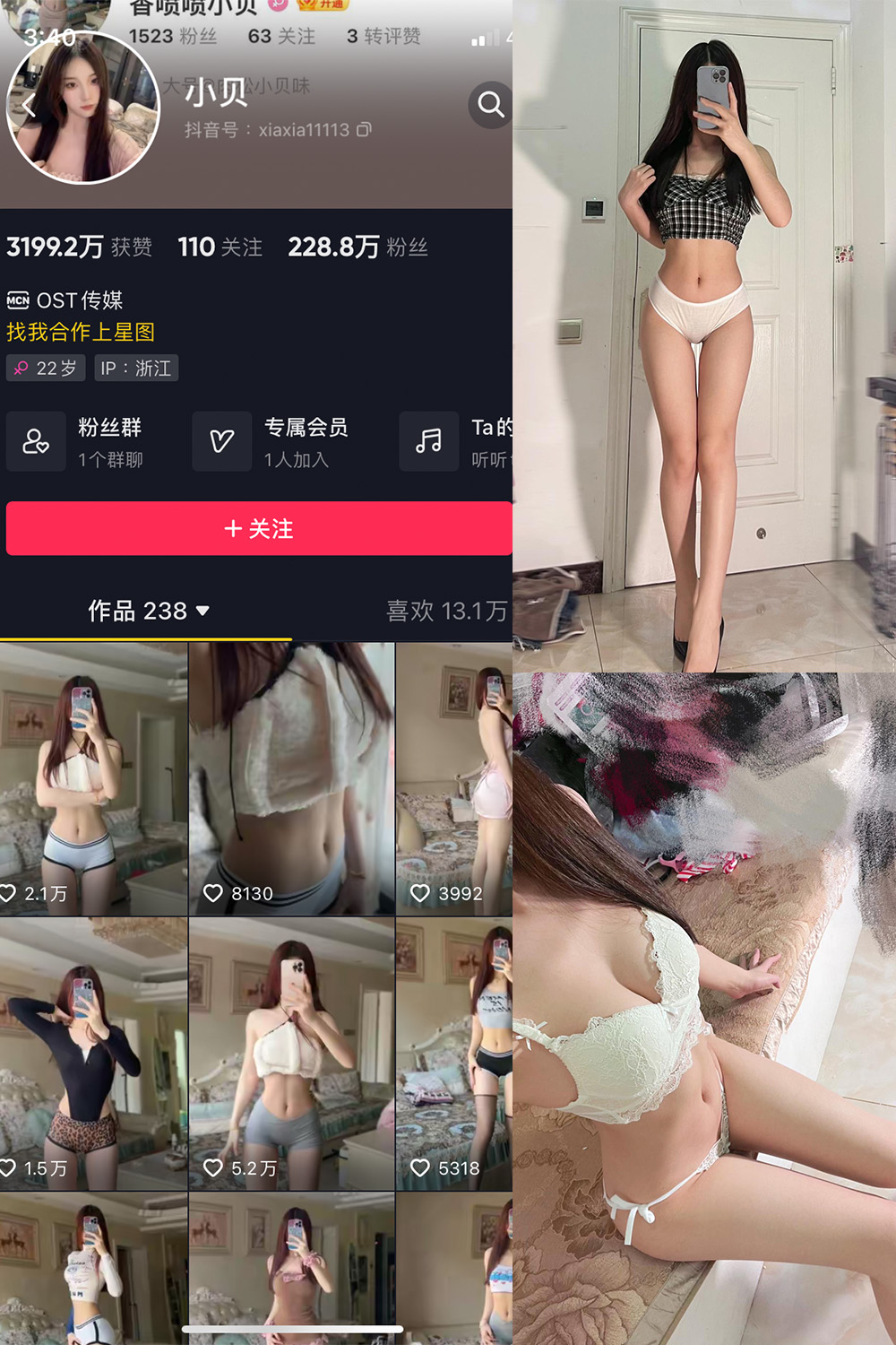 抖音 小贝 VIP 微密圈 NO.012期 【25P4V】-杏子