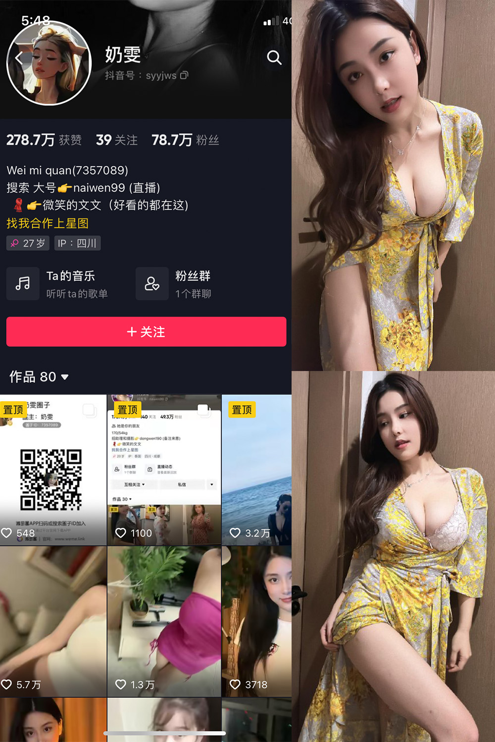 抖音 奶雯 微密圈  NO.025期 【7P】最新至：2023.11.10-杏子