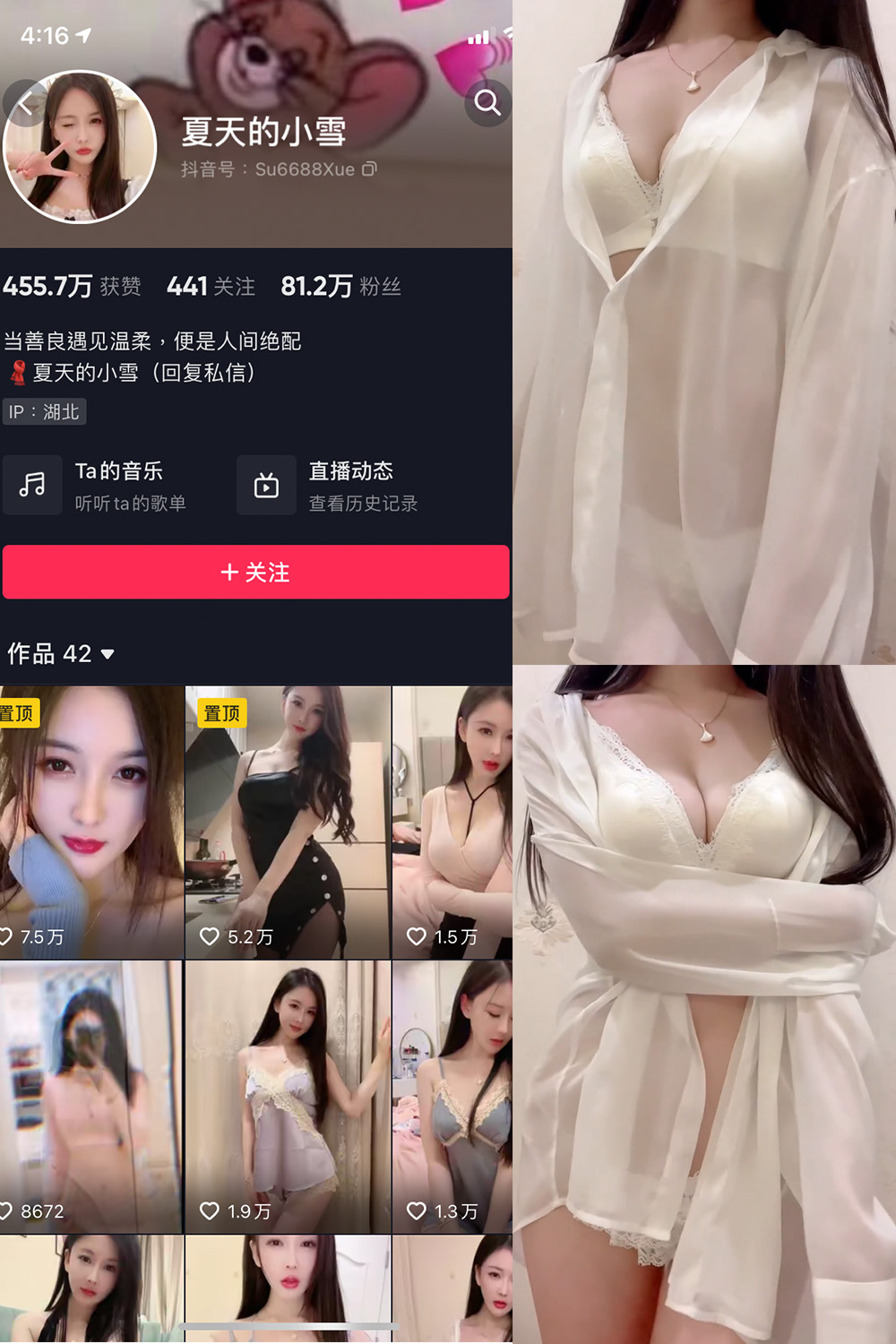 抖音 夏天的小雪 微密圈 嘉宾专享 NO.001-011期 最新至：2023.8.11-杏子