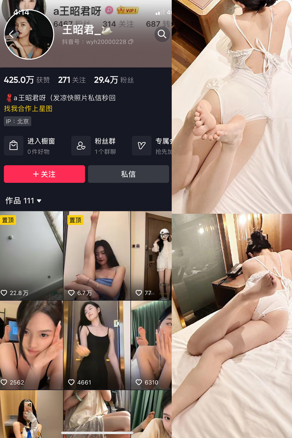 抖音 王昭君 微密圈  NO.023期 【29P6V】最新至：2024.6.6-杏子