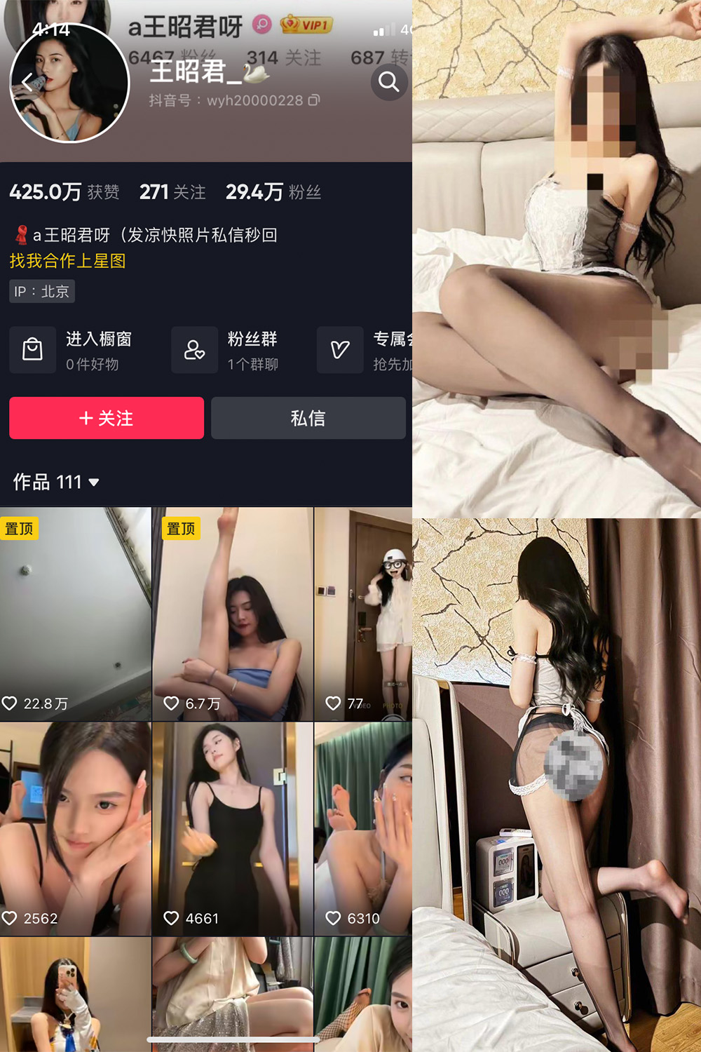 抖音 王昭君 微密圈  NO.020期 【8P2V】最新至：2023.12.04-杏子
