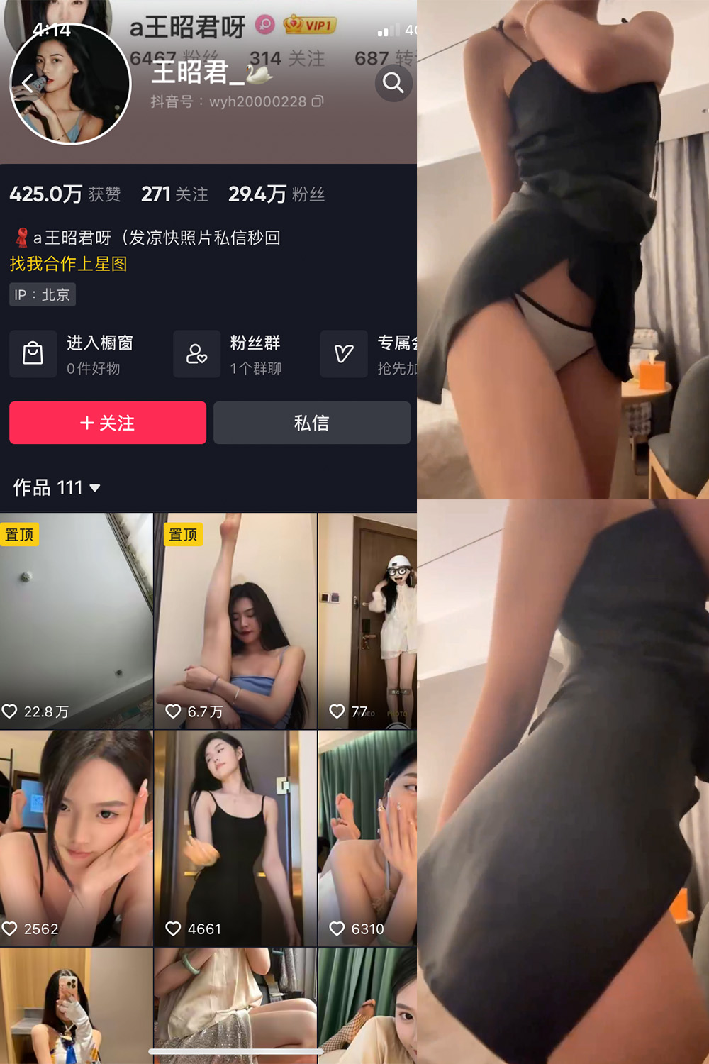 抖音 王昭君 微密圈  NO.010期 【11P1V】最新至：2023.6.10-杏子