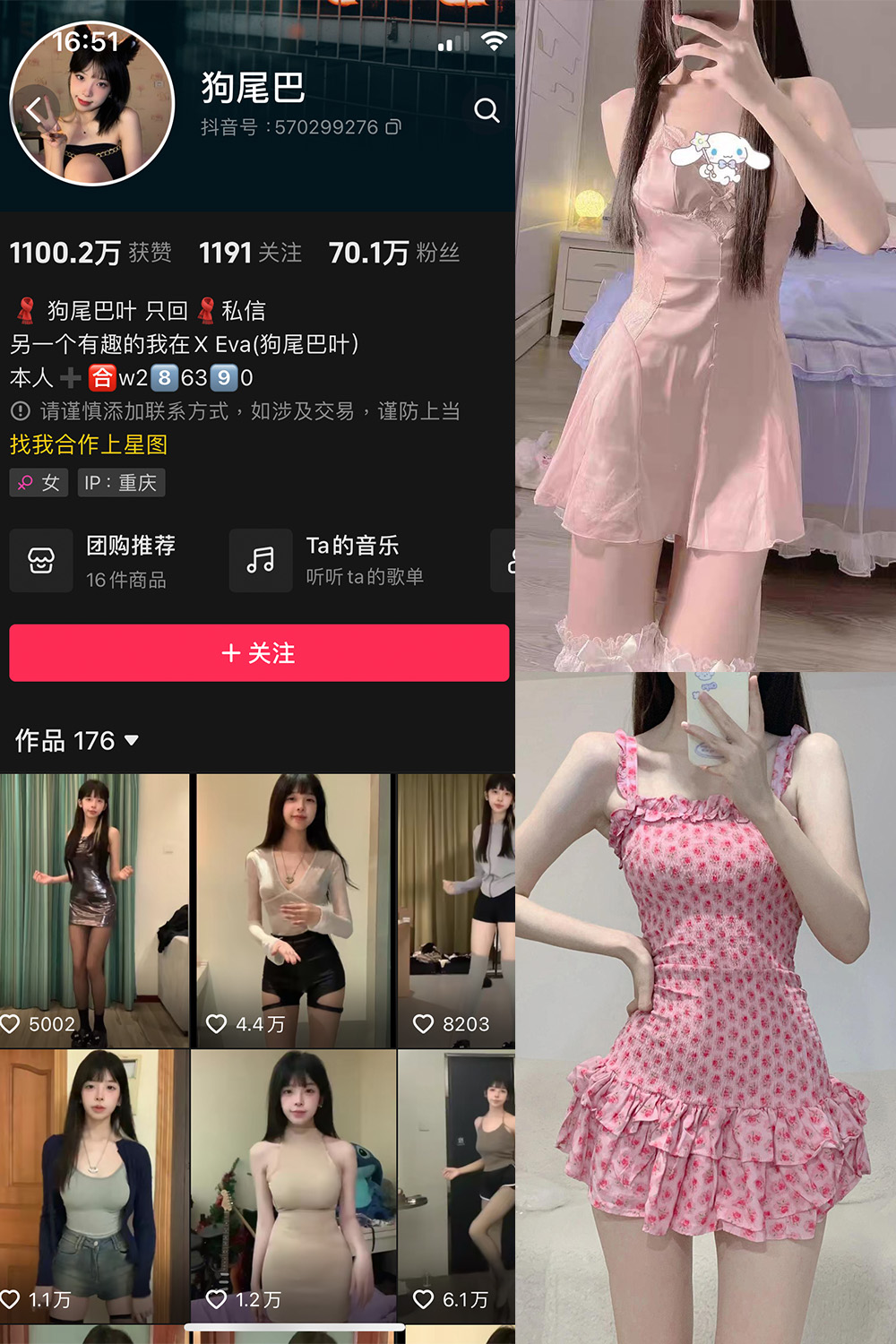 抖音 狗尾巴 微密圈  NO.004期 【25P5V】-杏子
