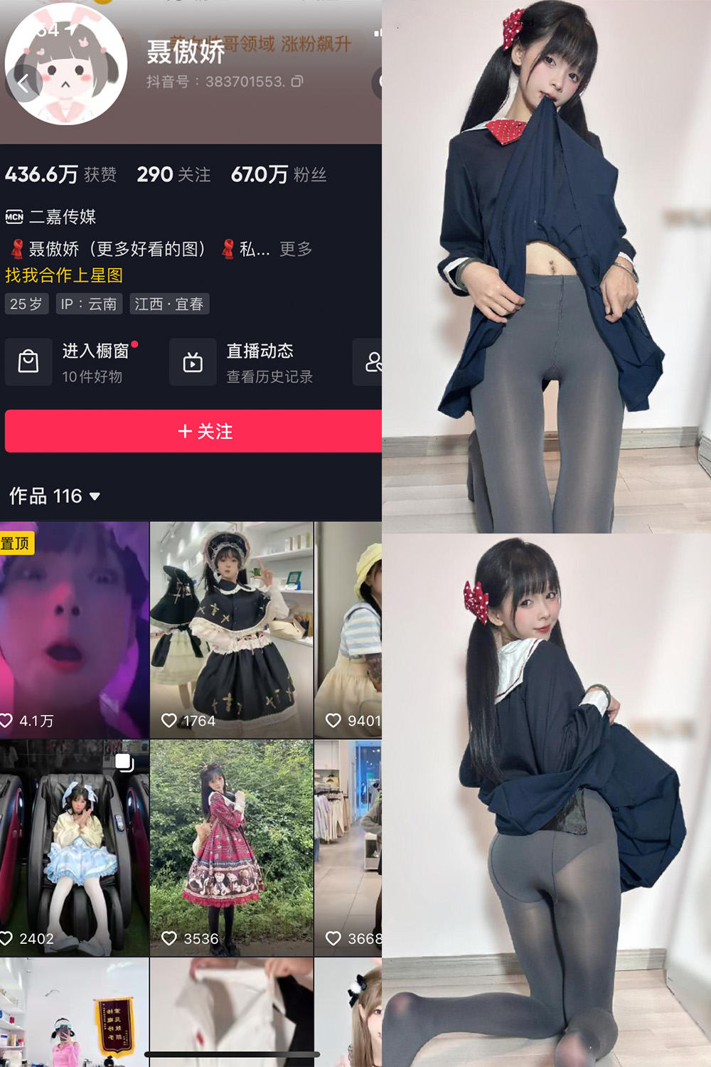 抖音 聂傲娇 微密圈  NO.066期 【23P】最新至：2024.5.9-杏子