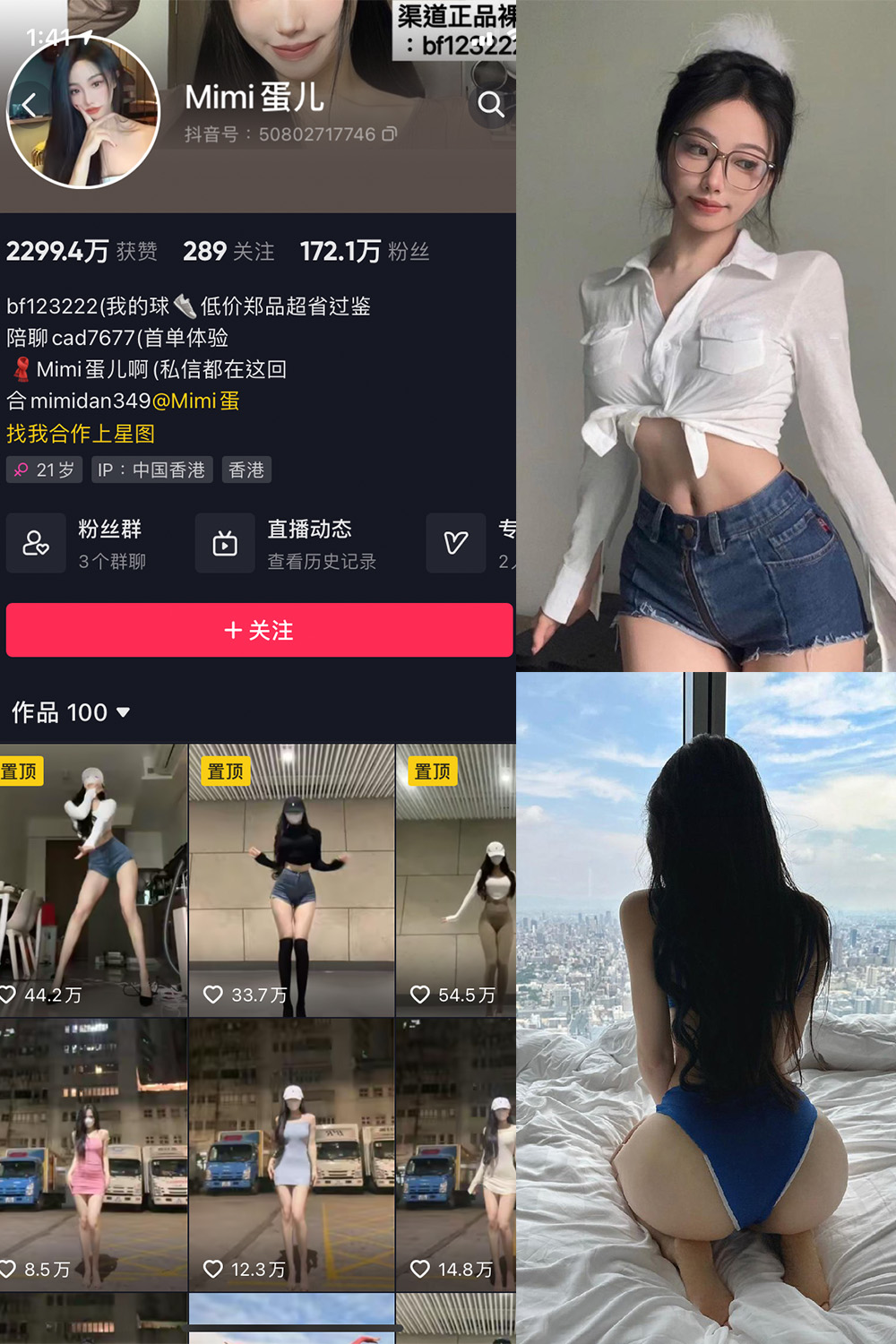 抖音 MImi蛋儿 微密圈 NO.002期 【8P1V】最新至：2023.6.27-杏子