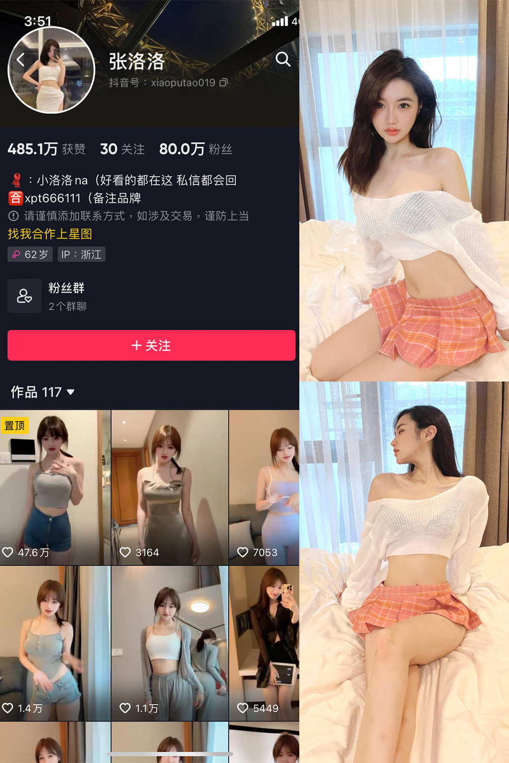 抖音 张洛洛 微密圈 NO.001期 【30P】-杏子