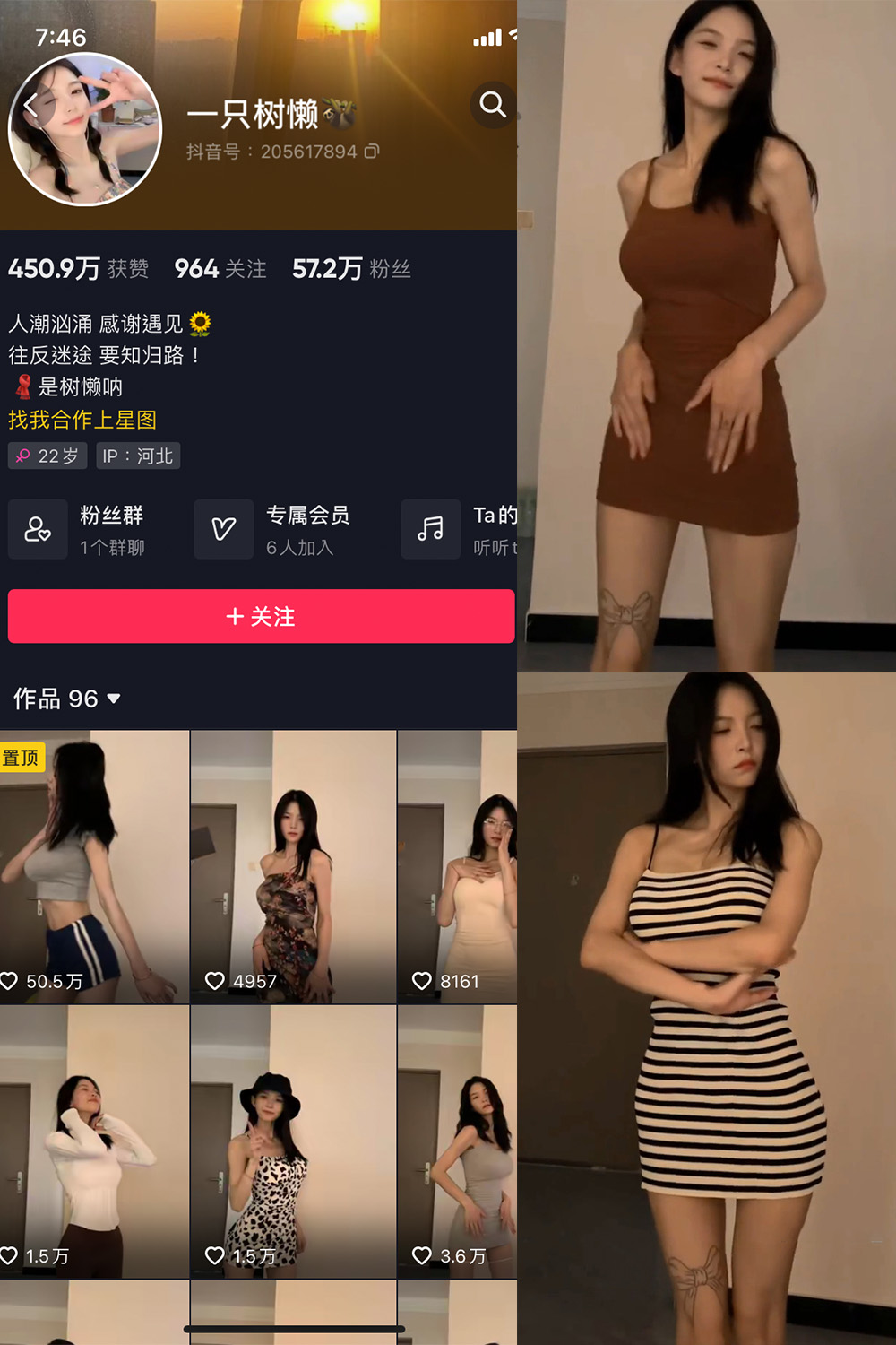 抖音 一只树懒 微密圈  NO.004期 【21P10V】-杏子