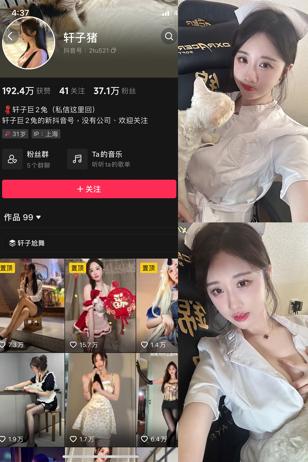 抖音 轩子巨二兔 微密圈  NO.023期 【8P1V】最新至：2024.3.15-杏子