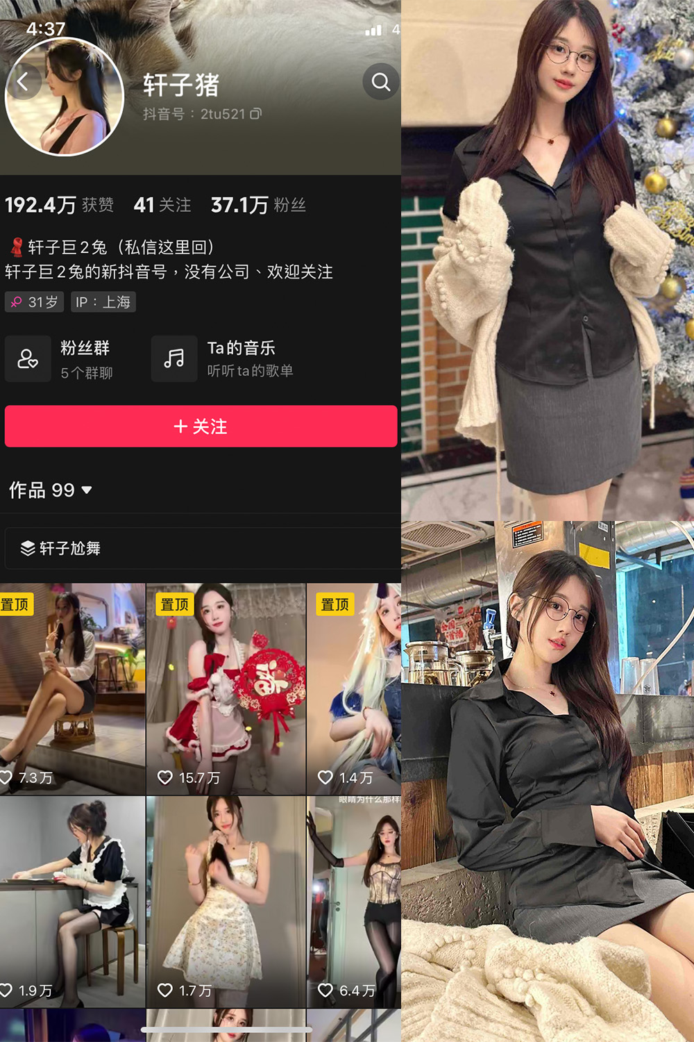 抖音 轩子巨二兔 微密圈  NO.016期 【10P】最新至：2023.11.30-杏子