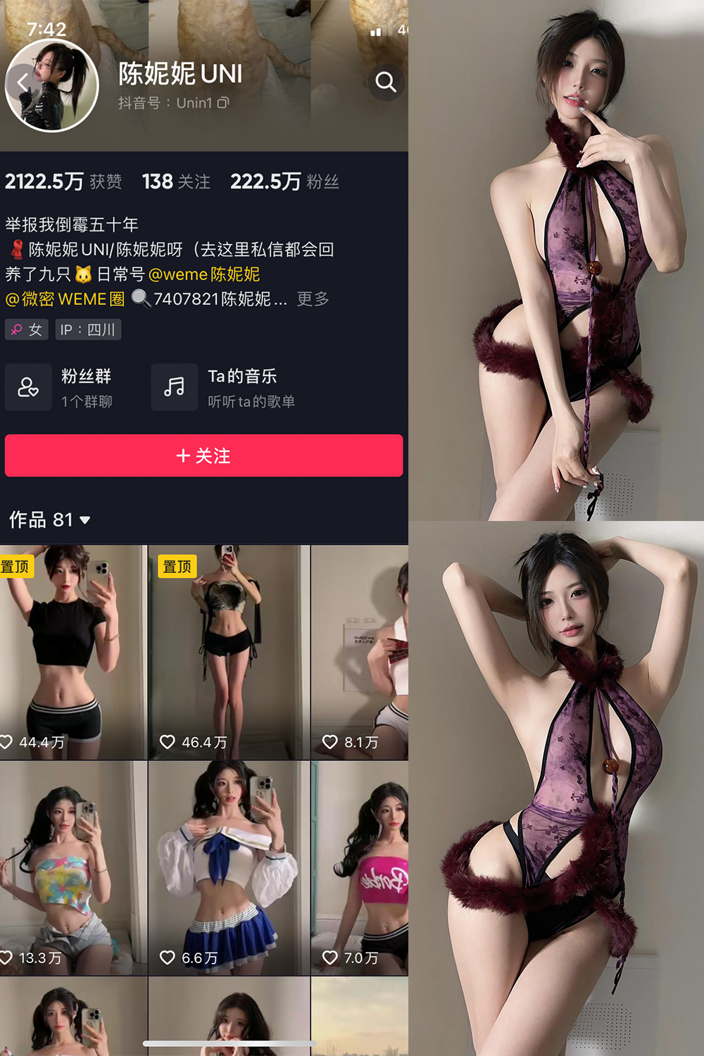 抖音 陈妮腻UNI 微密圈  NO.075期 【37P】最新至：2024.1.10-杏子