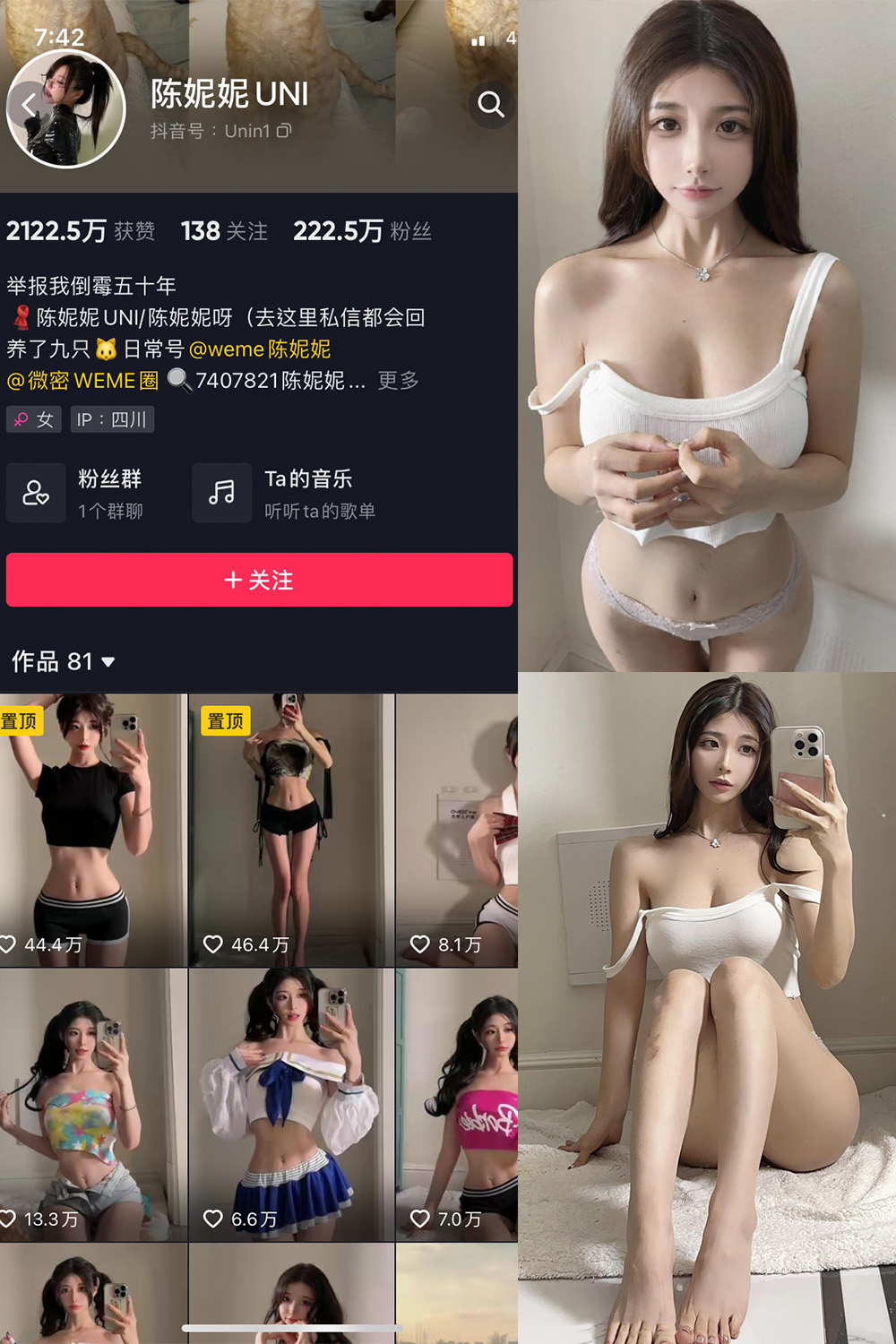 抖音 陈妮腻UNI 微密圈  NO.063期 【24P1V】-杏子