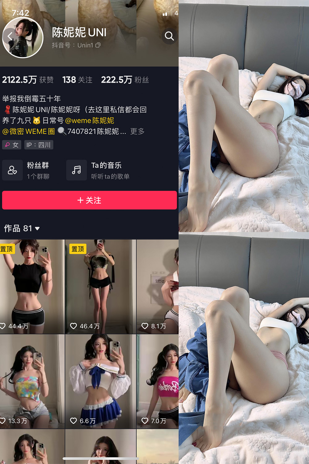 抖音 陈妮腻UNI 微密圈  NO.053期 【13P】-杏子