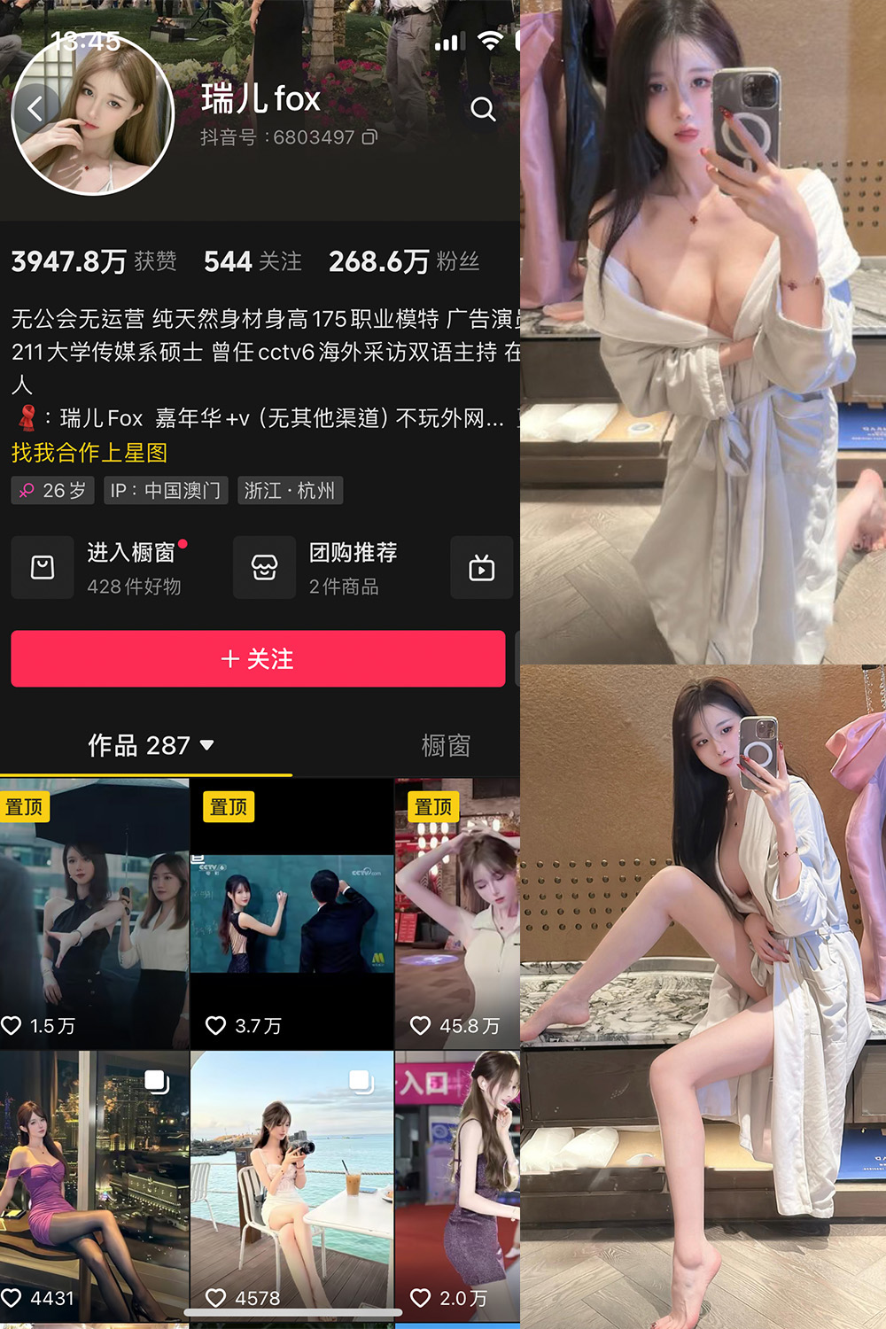 抖音 瑞儿fox 微密圈  NO.007期 【25P】最新至：2024.9.13-杏子