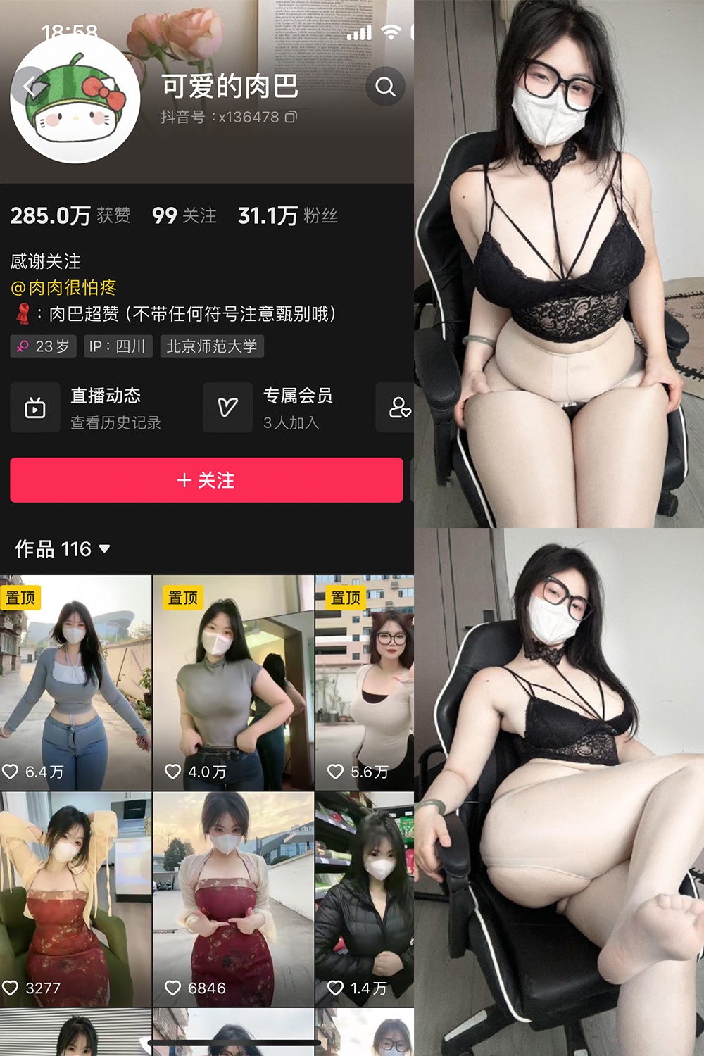 抖音 可爱的肉巴 微密圈  NO.022期 【25V】最新至：2024.4.25-杏子