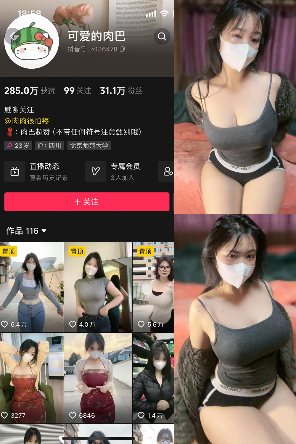 抖音 可爱的肉巴 微密圈  NO.011期 【14P6V】最新至：2024.2.19-杏子