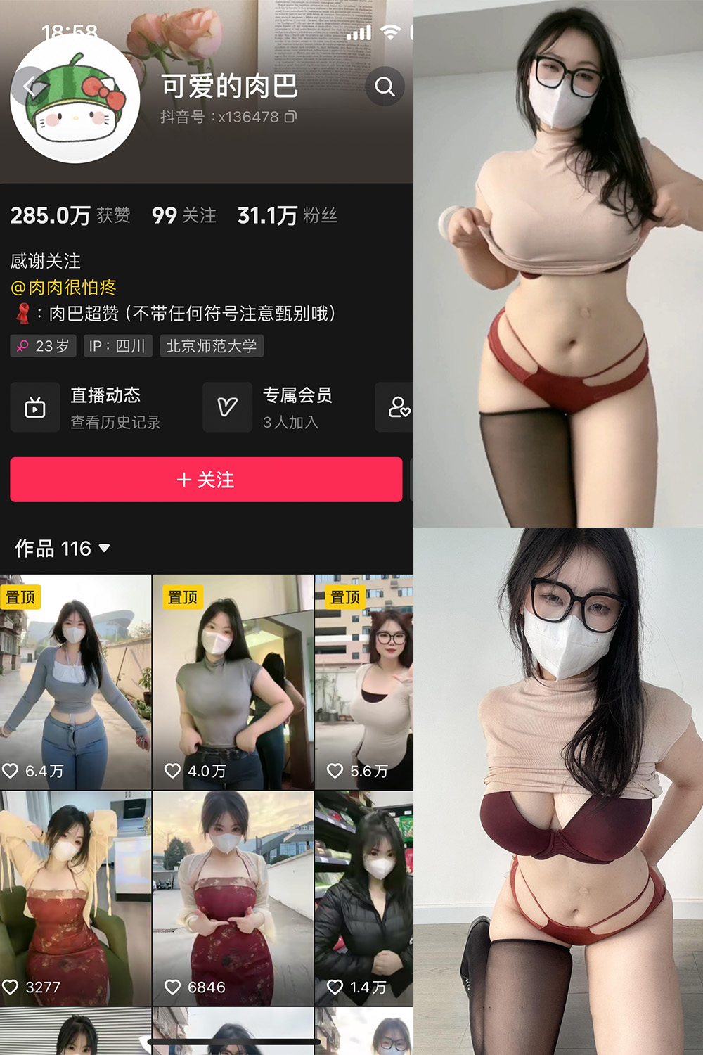 抖音 可爱的肉巴 微密圈  NO.009期 【18P11V】最新至：2024.11.7-杏子