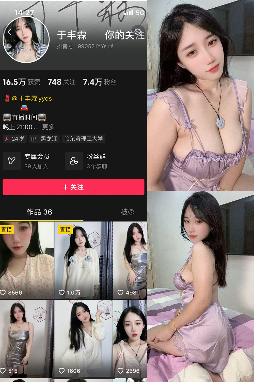 抖音 于丰霖 微密圈 NO.009期 【19P12V】最新至：2024.9.8-杏子