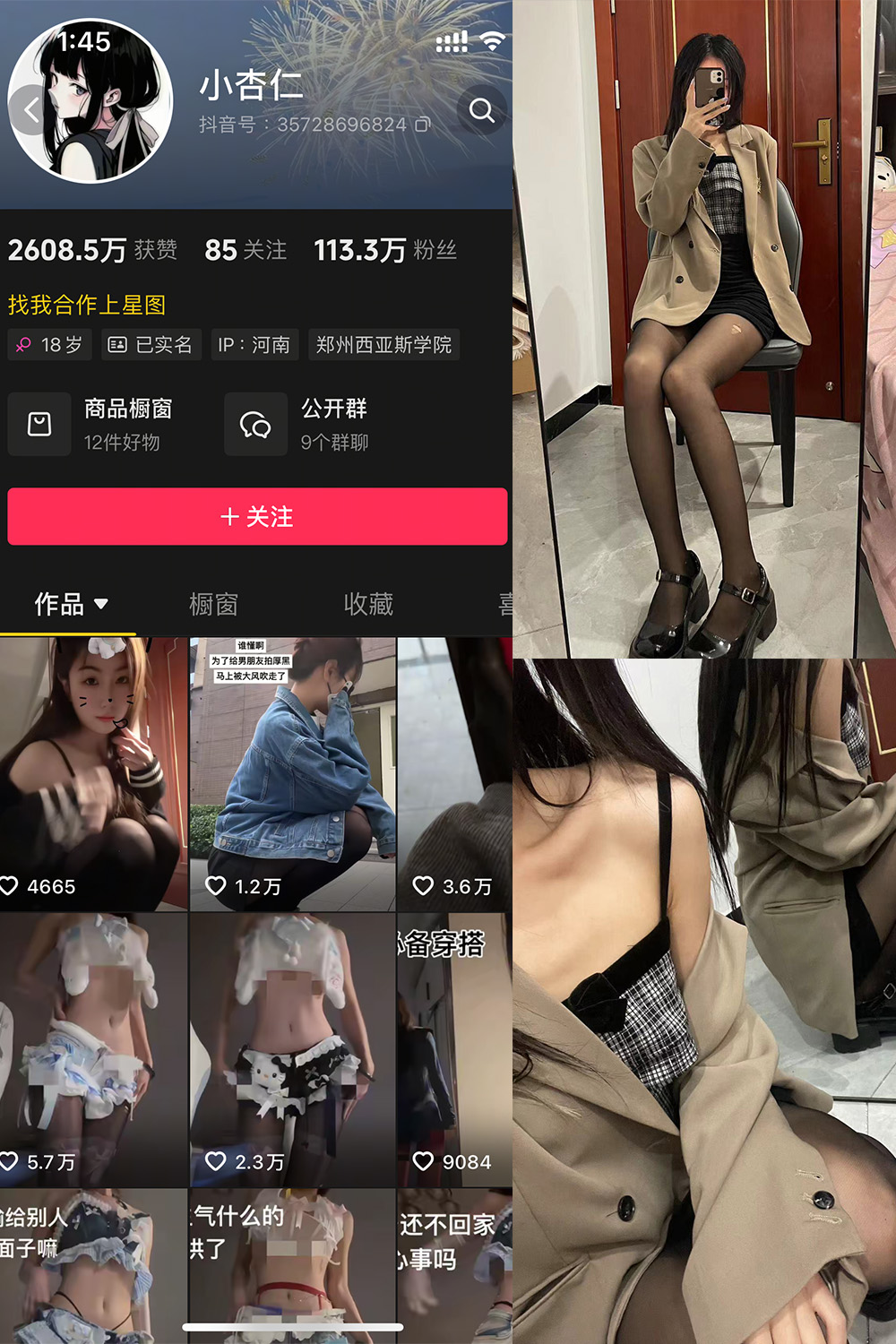 抖音 小杏仁 微密圈  NO.007 【61P】最新至：2025.3.10-杏子